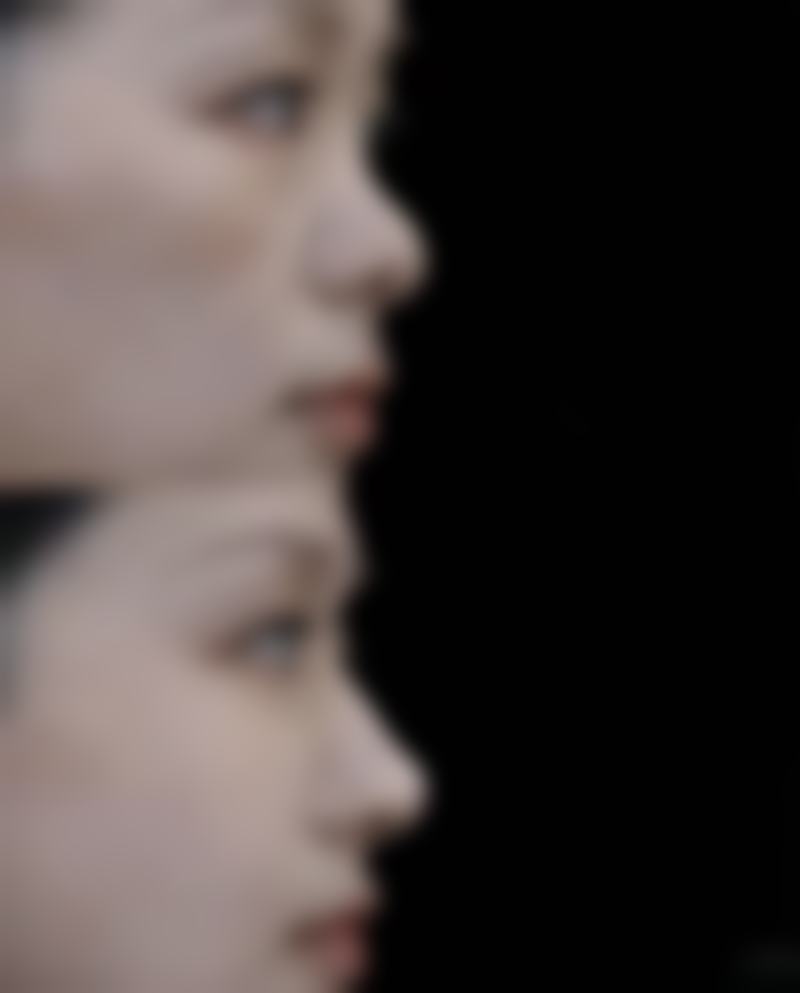 【天门市竟陵忆美整形医院参考价格表：】