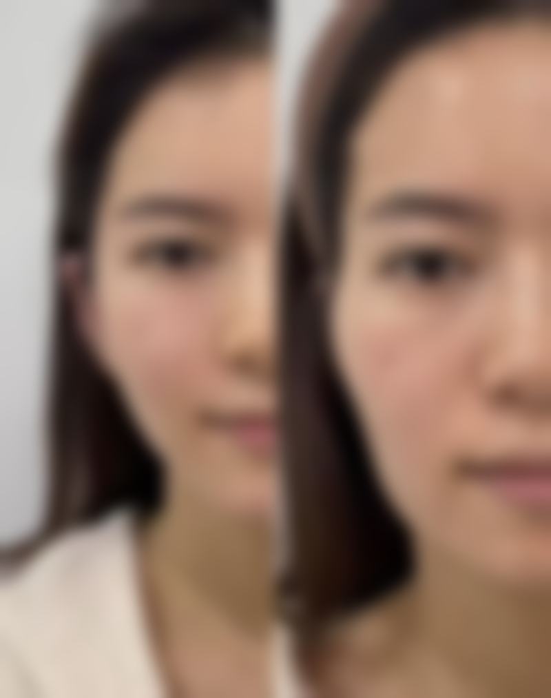 【深圳希思整形医疗美容医院地址：】