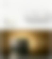 颧骨太高磨骨手术对比照片