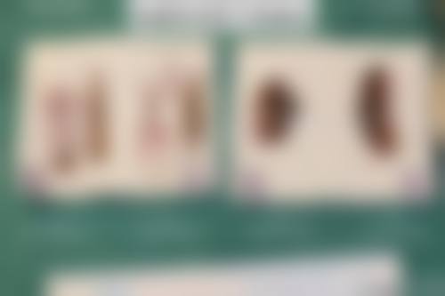 【青岛嘉美邦医疗整形美容参考价格表：】