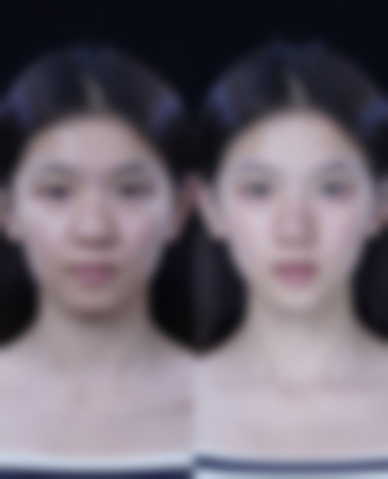 【石家庄喜盟荟医疗美容门诊部（原面容管家）是正规的吗?】