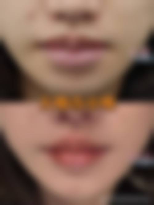 【韩城颜即联禾丽致整形医院特色项目：】