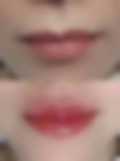 【韩城颜即联禾丽致整形医院核心优势：】