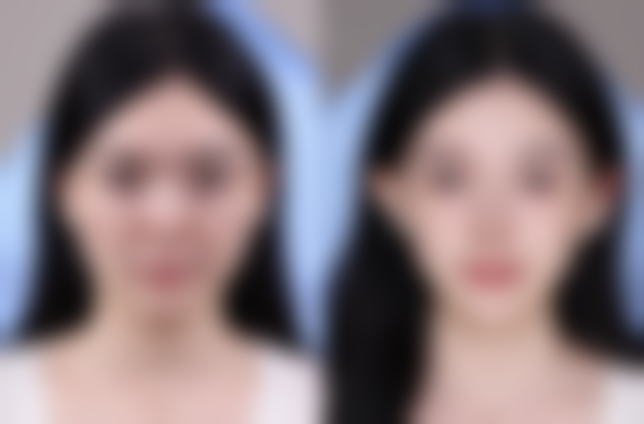 【刘忠梅医生擅长项目】