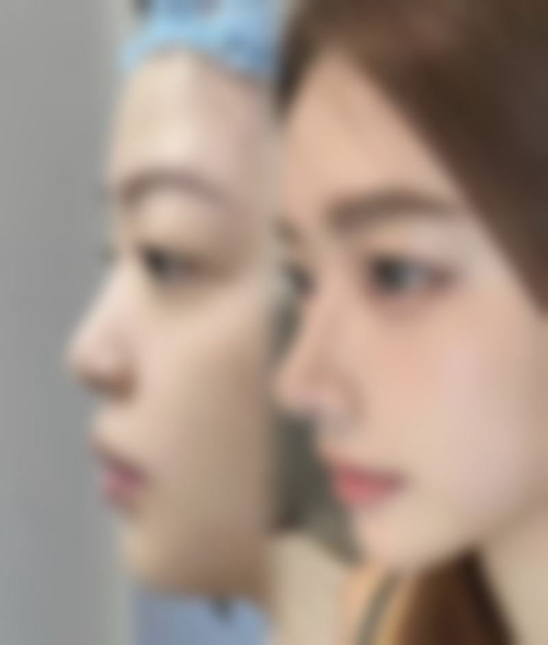 【商丘市第一人民医院皮肤科地址：】