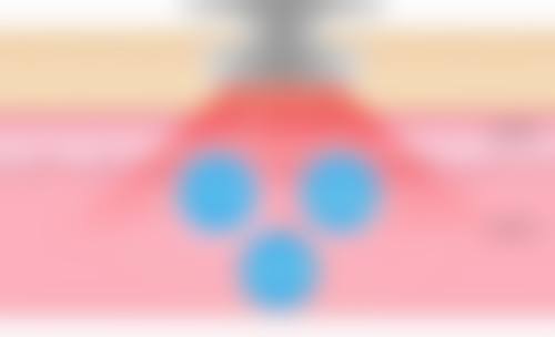 看需求
