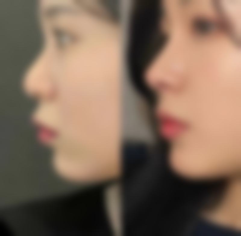 【广州天天一美整形医院怎么预约挂号?】