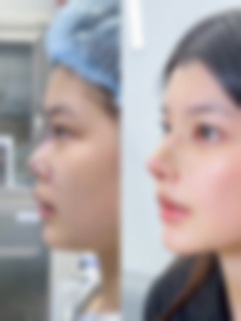 【郑州中原黄大同整形医疗美容诊所患者口碑评价：】