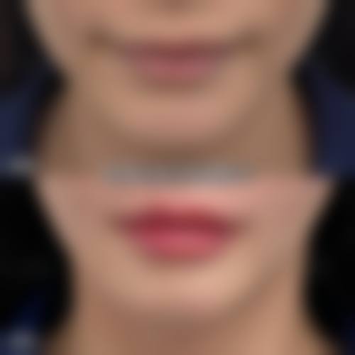 评价一：“在青岛杨博医疗美容诊所做了激光美容，成效真的太让我惊喜了！之前脸上的色斑淡化了特别多，皮肤也变得更加光滑细腻。医生和护士都特别专精，服务也特别贴心，整个过程都特别舒适。”