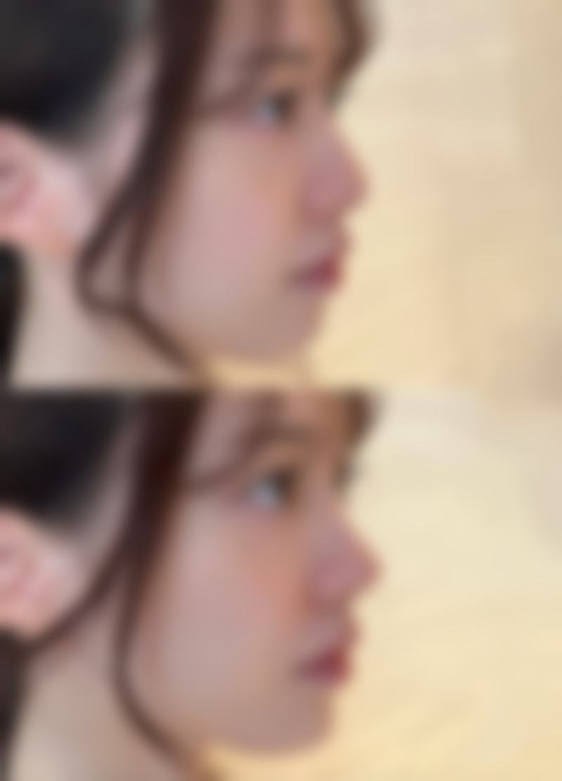 【潍坊伊博士整形美容医院特色项目：】