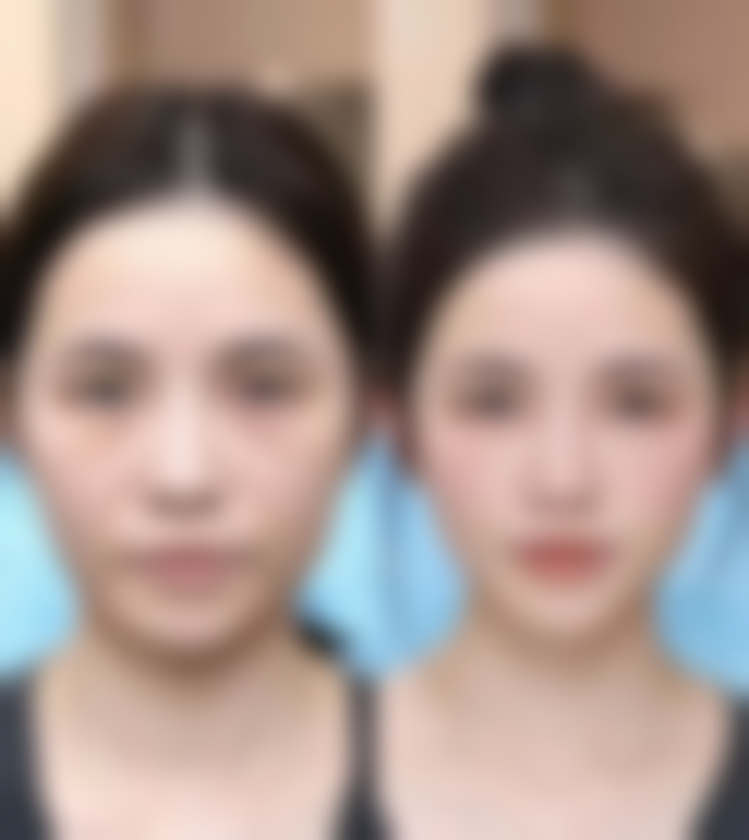 【潍坊伊博士整形美容医院地址：】