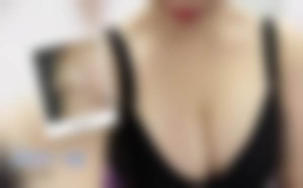 伊婉C 1ml玻尿酸除皱项目的技术优势