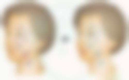 种植头发能自然生长吗？