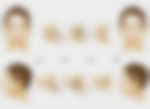 种植头发怎么收费？