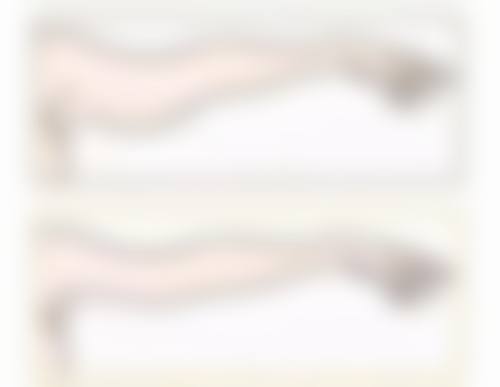 打瘦脸针后什么时候可以洗脸