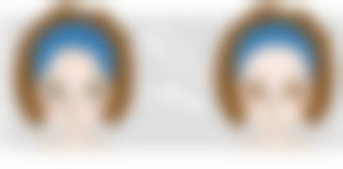 面部除皱术需要多少钱