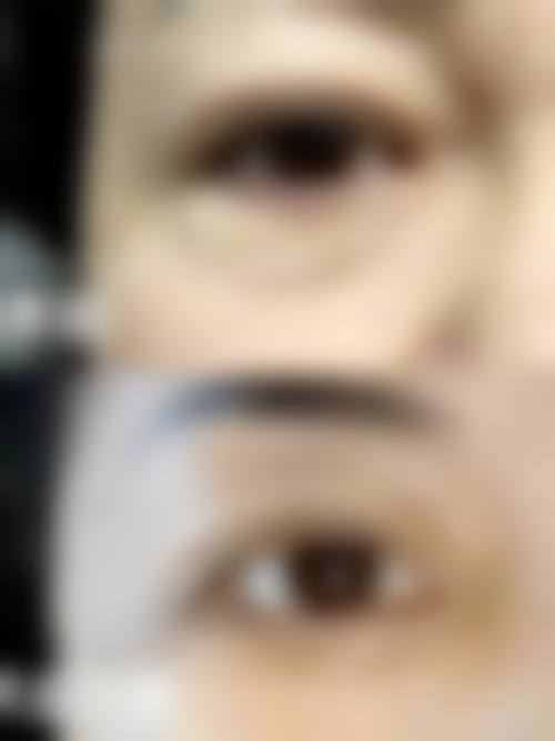 【福鼎星范医疗美容诊所参考价格表：】