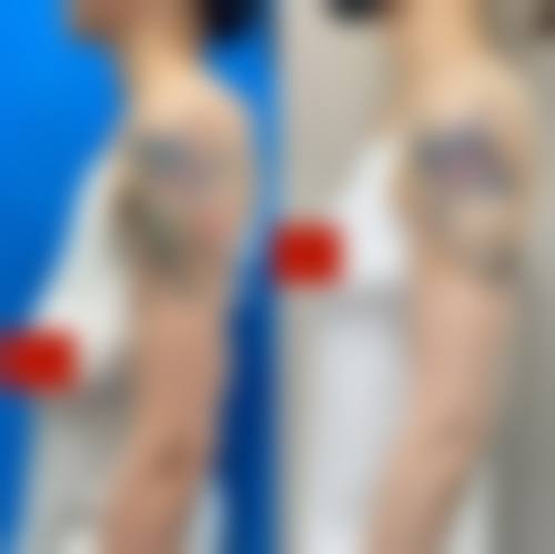 【高安黄敏医疗美容诊所特色项目：】