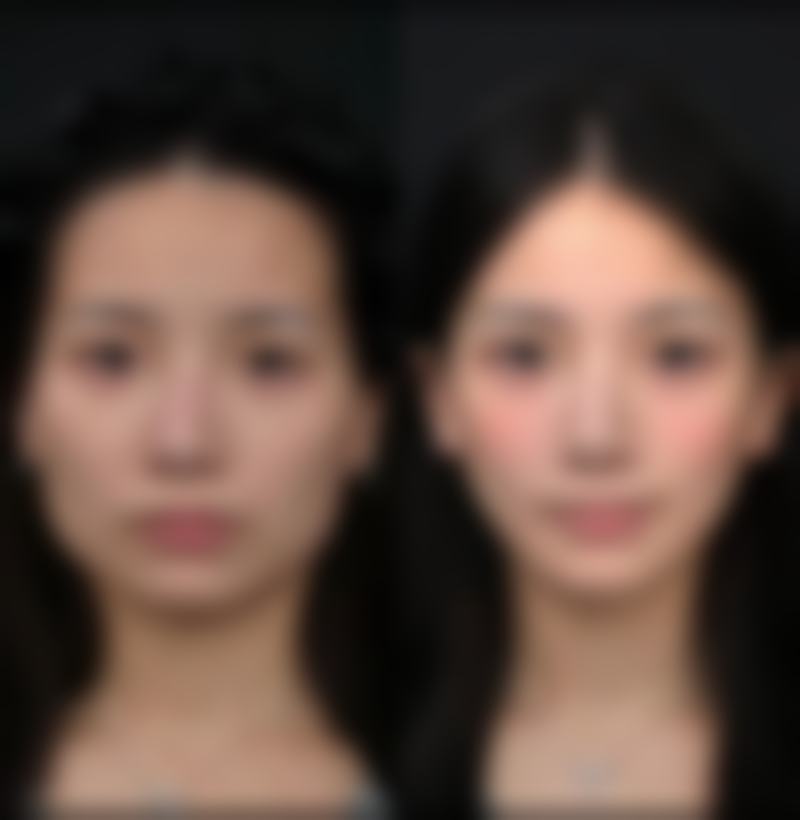 【深圳康华门诊部整形美容中 心地址：】