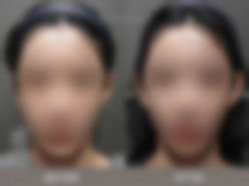 【重庆光博士医疗美容医院怎么预约挂号?】