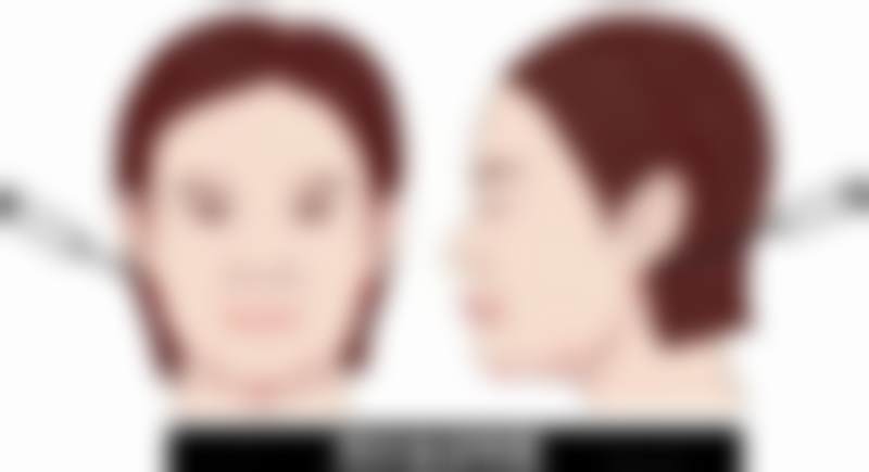 广州高尚医学美容中 心李春明做唇裂手术适合吗