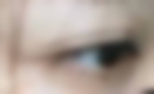 瘦脸针多久打一次可以维持恒久?