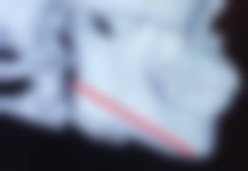 瘦脸针打一次维持多久