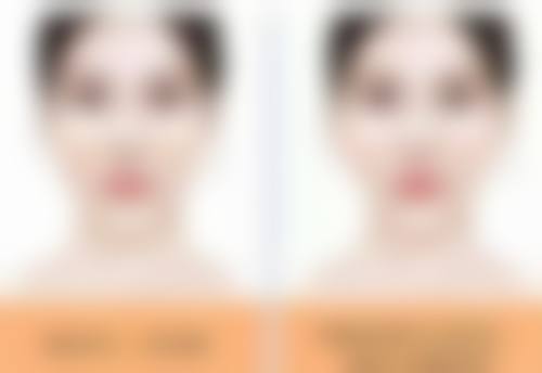 瘦脸针间隔多久打一次更好?