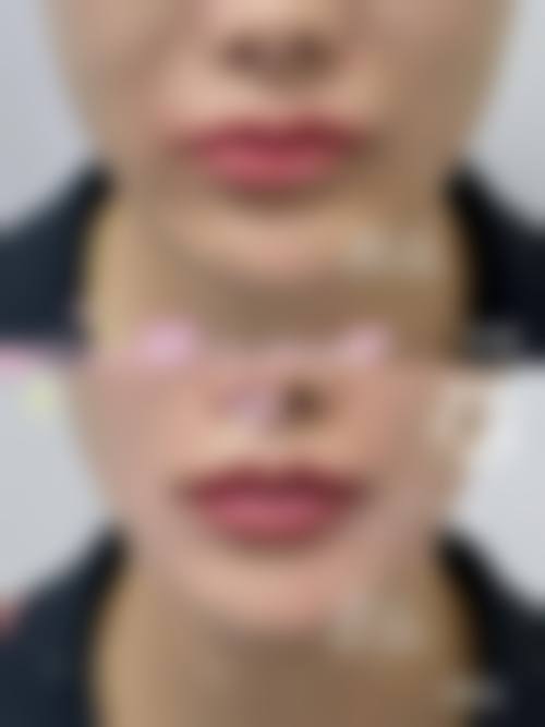 【西安卢丙仑琅丽医疗美容门诊部核心优势：】