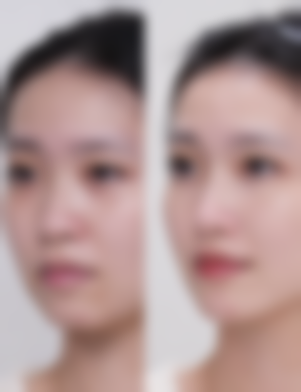 【韩国ROCOCO整形外科核心优势：】