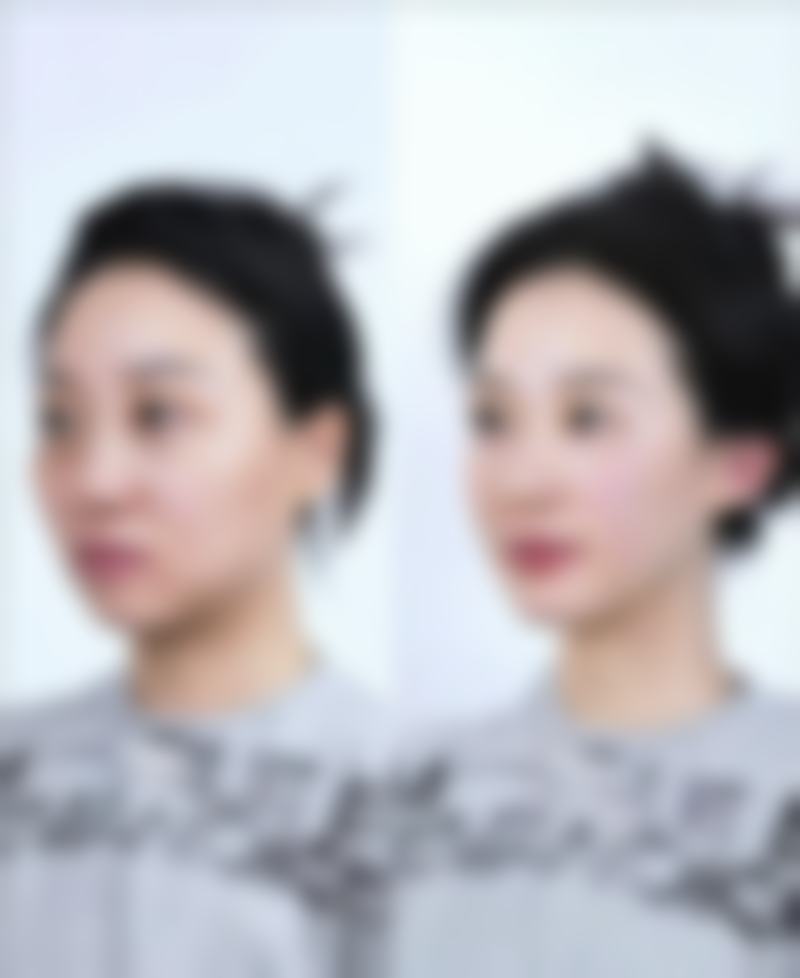 【湖南郴州市明华医院参考价格表：】