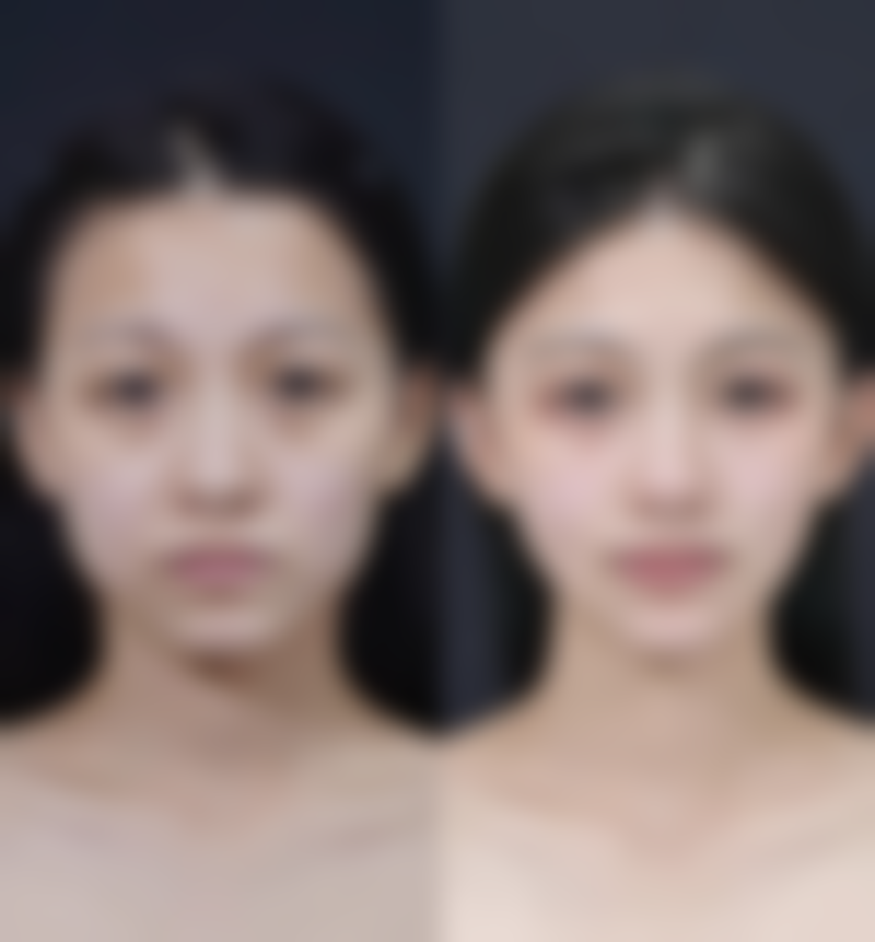 【湖南郴州市明华医院怎么预约挂号?】