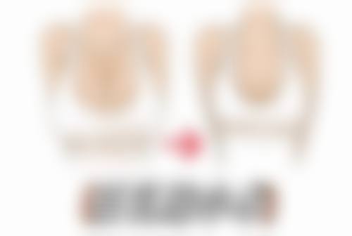 打完瘦脸针注意事项有哪些呢