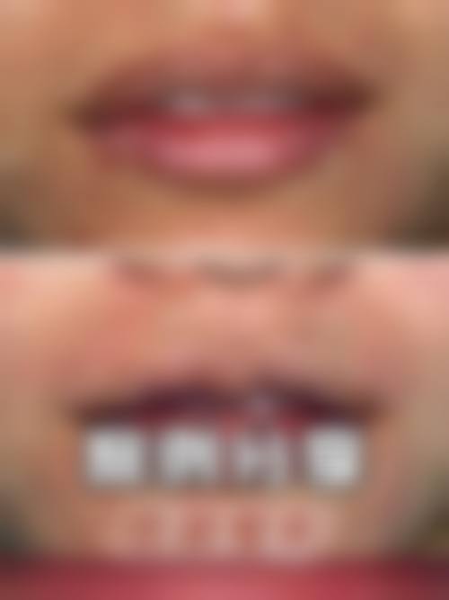 【泸州美馨医学整形美容诊所是正规的吗?】