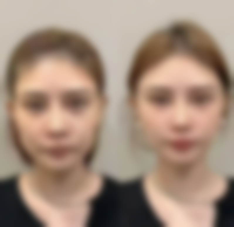 【文山悦她婕熹卡整形医院特色项目：】