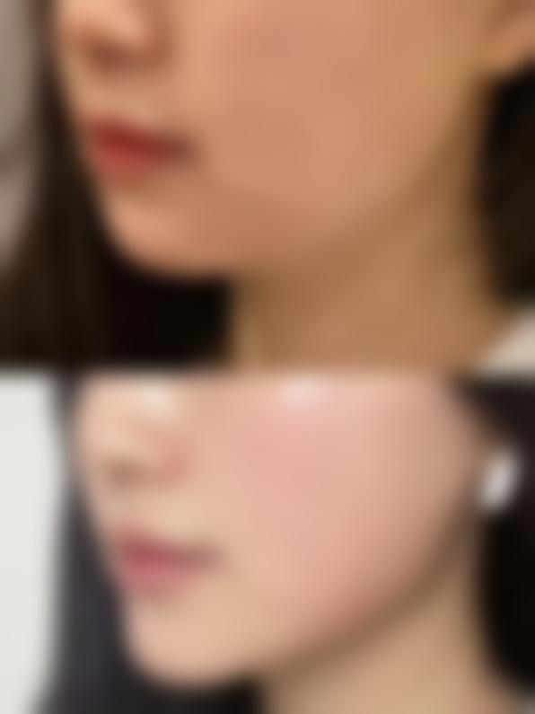 【泸州美馨医学整形美容诊所诊疗设备：】