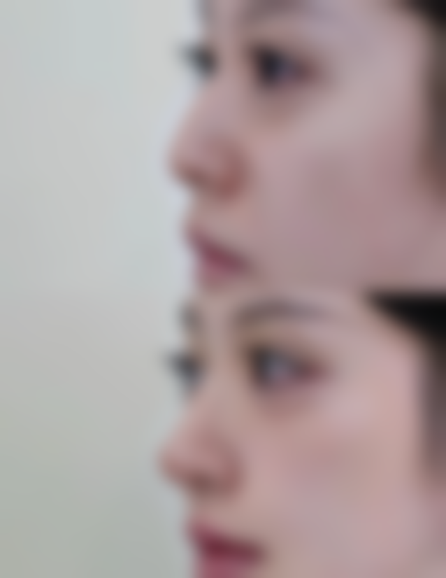 【文山悦她婕熹卡整形医院地址：】