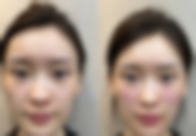 【文山悦她婕熹卡整形医院是正规的吗?】