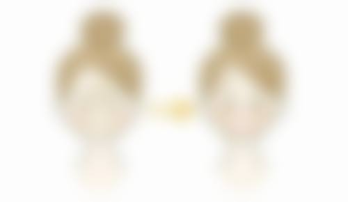 头发少可以种植吗啊？答案是肯定的！3大优势揭秘植发如何让头发少的你重获浓密发量！ 