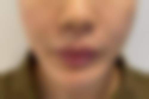 【福州渌美整形医院是正规的吗?】