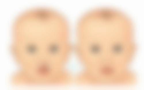 瘦脸针一边脸更多打多少ml