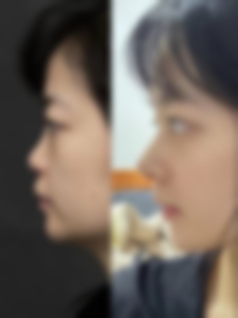 【益阳爱思特整形医疗美容医院是正规的吗?】