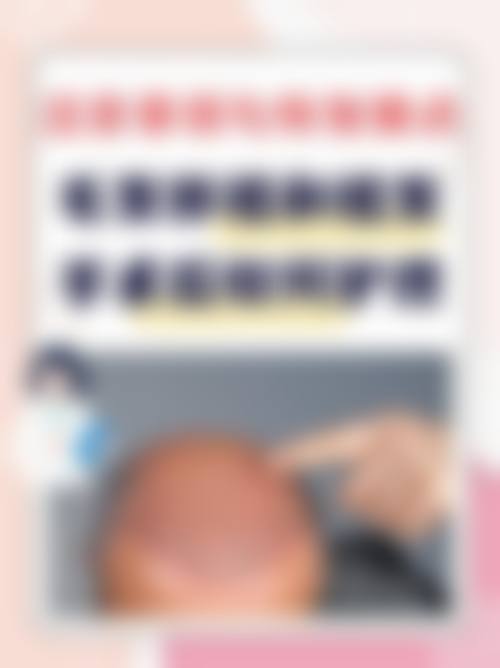 【于民医生擅长项目】
