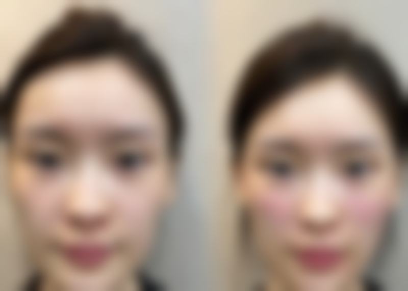 【石家庄市雅馨医疗整形美容参考价格表:】