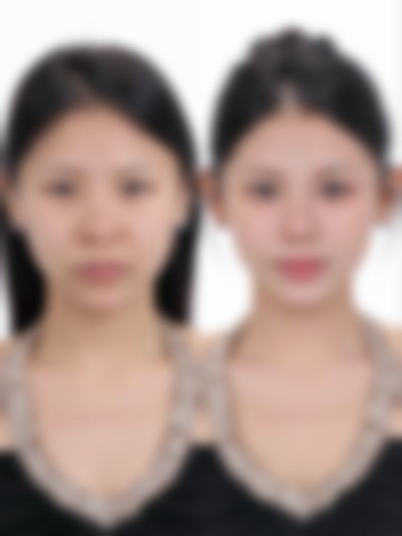 【温州和平整形医院整形美容医院怎么预约挂号?】