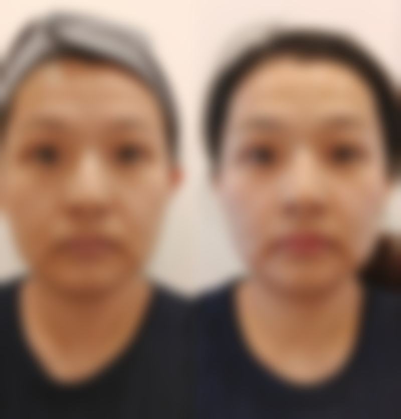 【武汉熙蒙整形医院特色项目:】