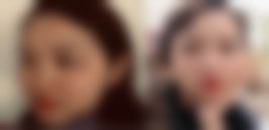【南昌爱思特(艾莱芙)美容医院患者口碑评价:】