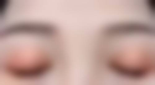 打瘦脸针多少钱