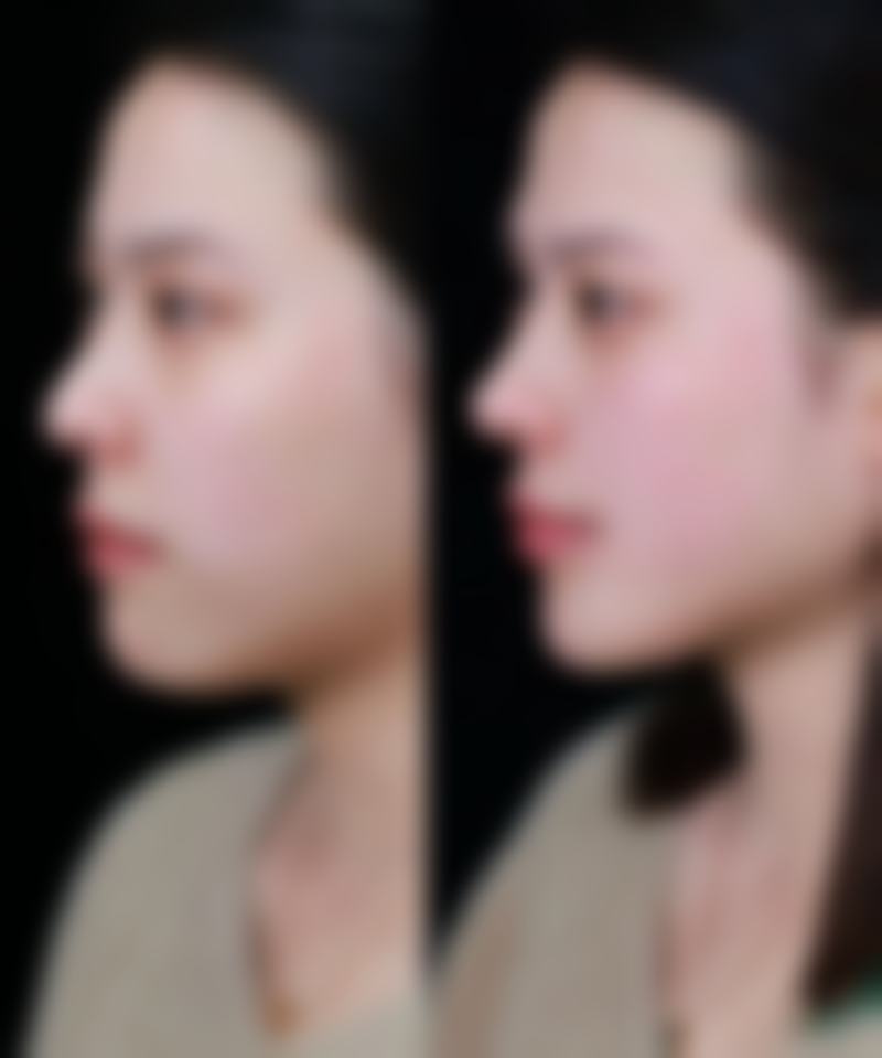 【成都欣亚医疗美容诊所特色项目:】