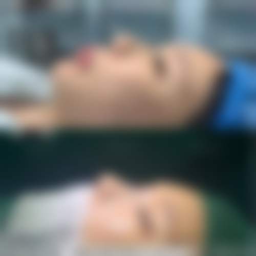 【金华丽都整形美容医院参考价格表:】